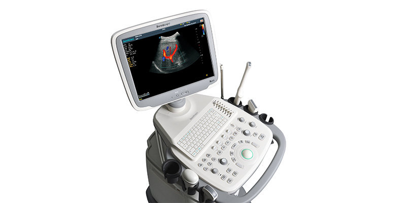 Hospital Medical Full Digital Trolley Color Doppler Ultrasound Machine Sonoscape S12