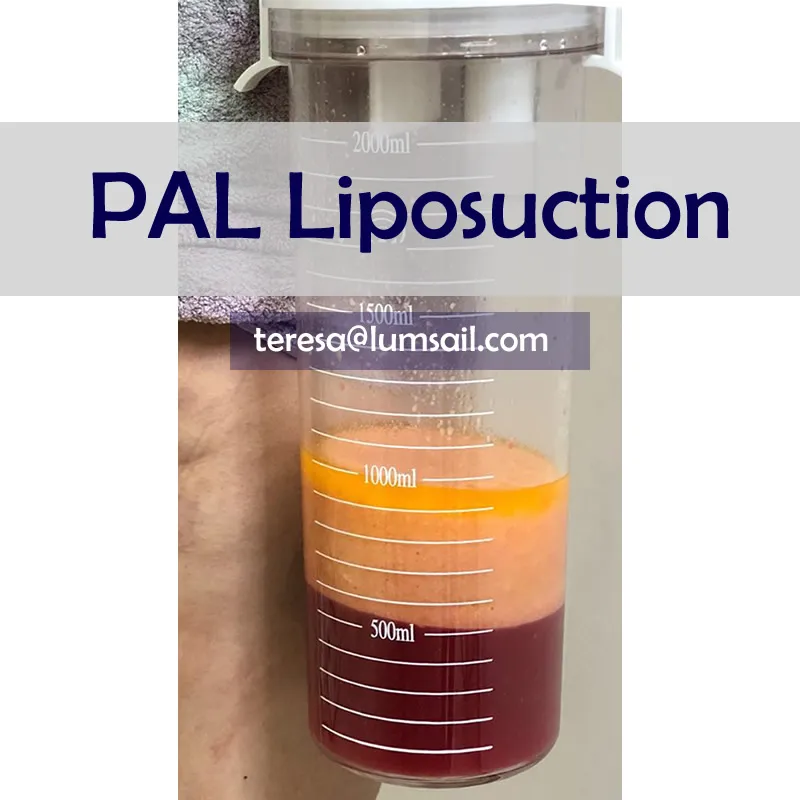 PAL Liposuction System 4