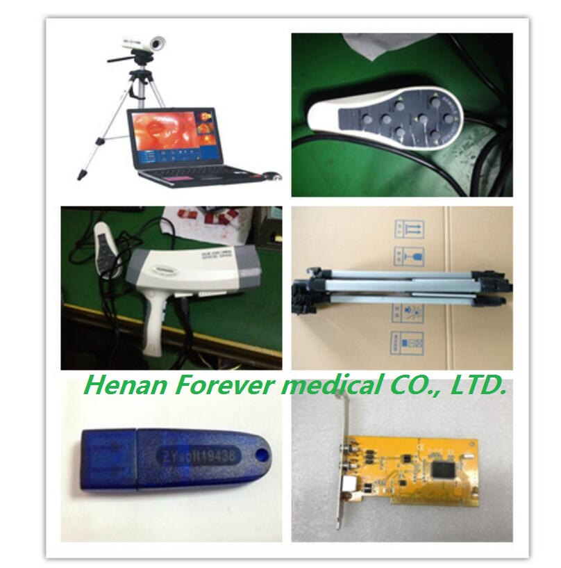 Ce Approved Portable Sony Colposcopy Systems for Gynecological (YJ-U150)