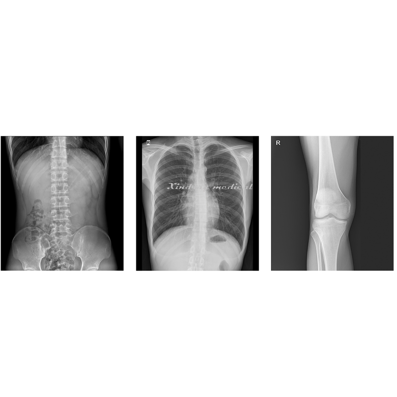 Medical Flat Panel Detector Based UC-Arm Digital X-ray Radiography System