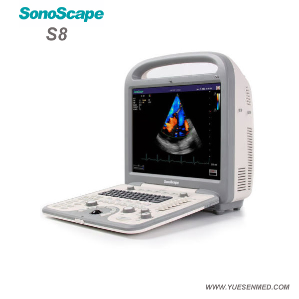 Medical Hospital Sonoscape S8 Portable 4D Color Doppler Ultrasound Machine