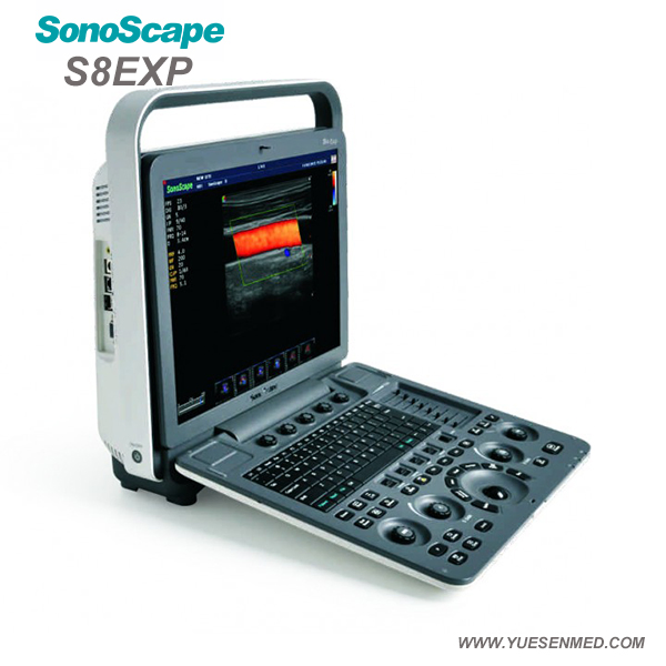 Medical Equipment Hospital Sonoscape S8exp Portable Cardiac Color Doppler Ultrasound Machine