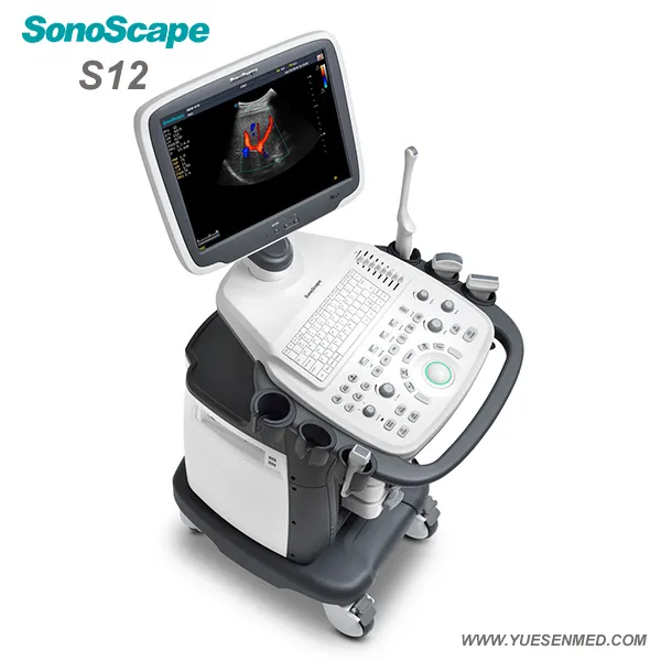 Ultrasound Machine View 2