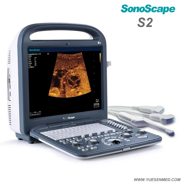 Ultrasound Scanner View 1