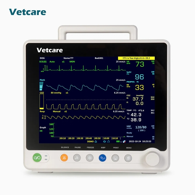 Advanced Cardiac Monitoring System for ECG Results Analysis Portable EKG Machine