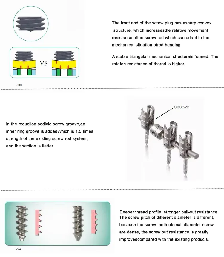 Fixation System Detail