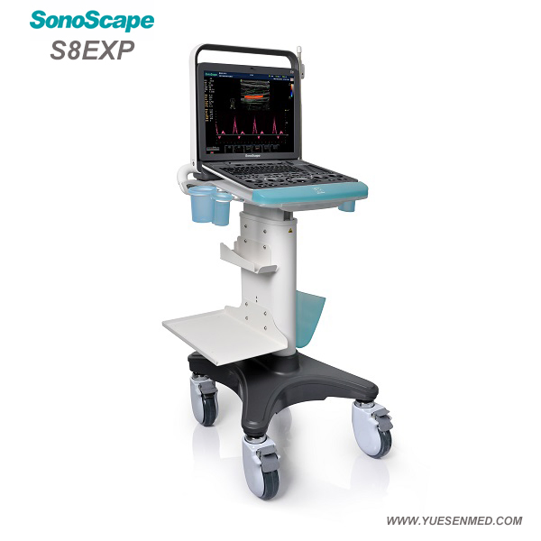 Medical Equipment Hospital Sonoscape S8exp Portable Cardiac Color Doppler Ultrasound Machine