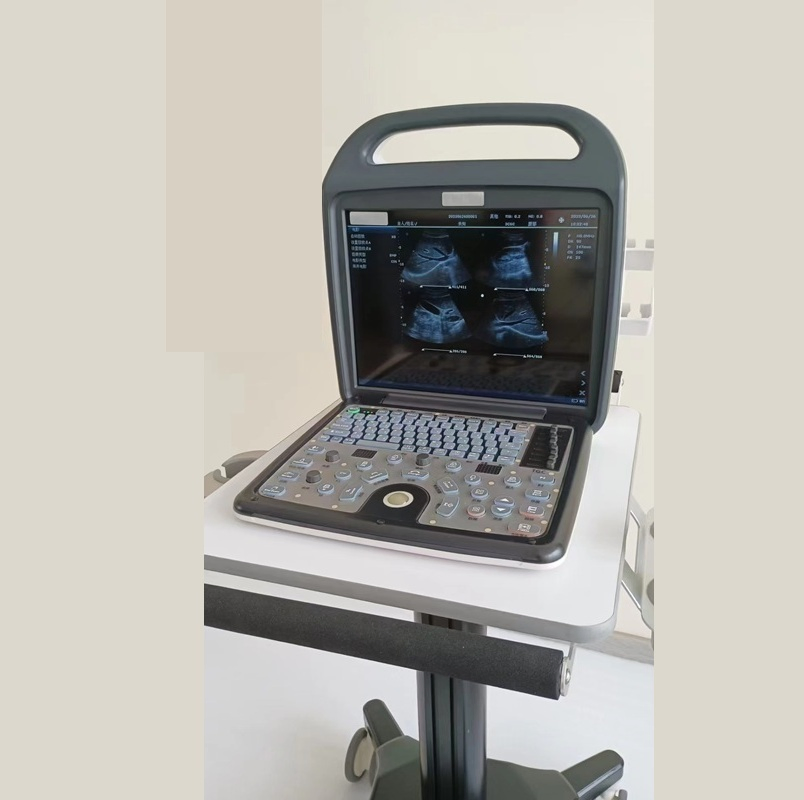 Umus069 All-in-One Color Doppler Ultrasound--Perfect for Clinics and Veterinary Practices