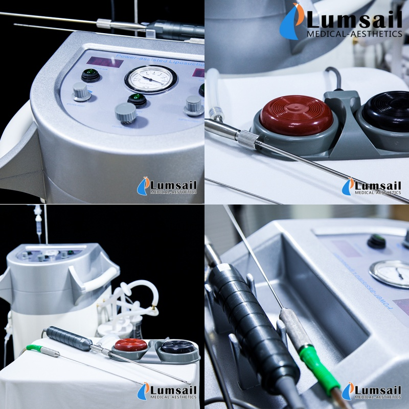 One-Stop Solution Surgical PAL Liposuction with Tumencent Injection System