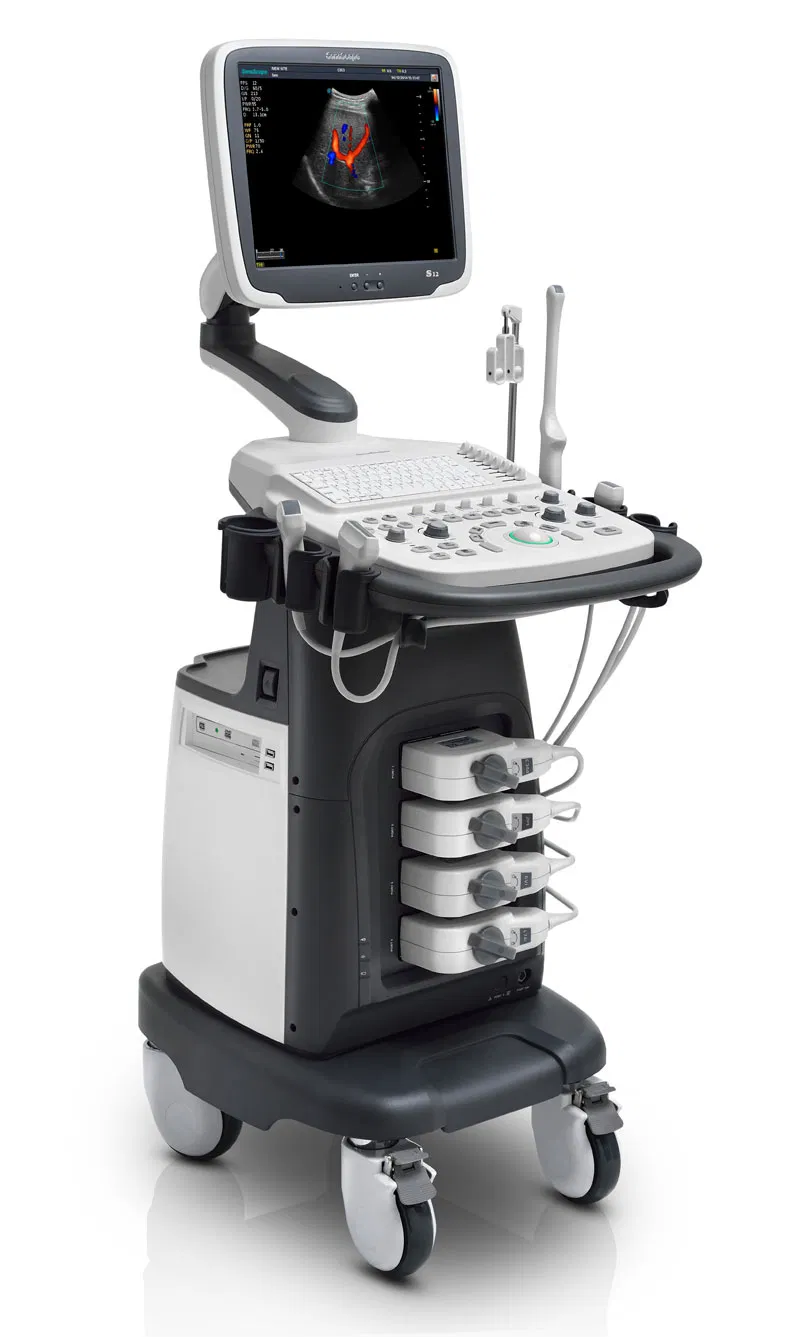 Hospital Medical Full Digital Trolley Color Doppler Ultrasound Machine Sonoscape S12