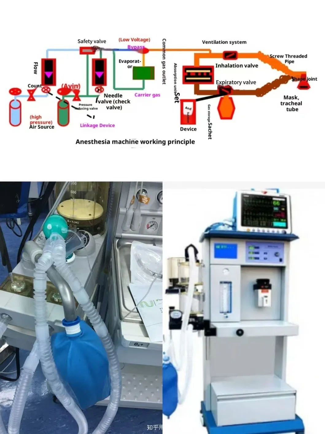 Anesthesia Circuit Usage Workflow