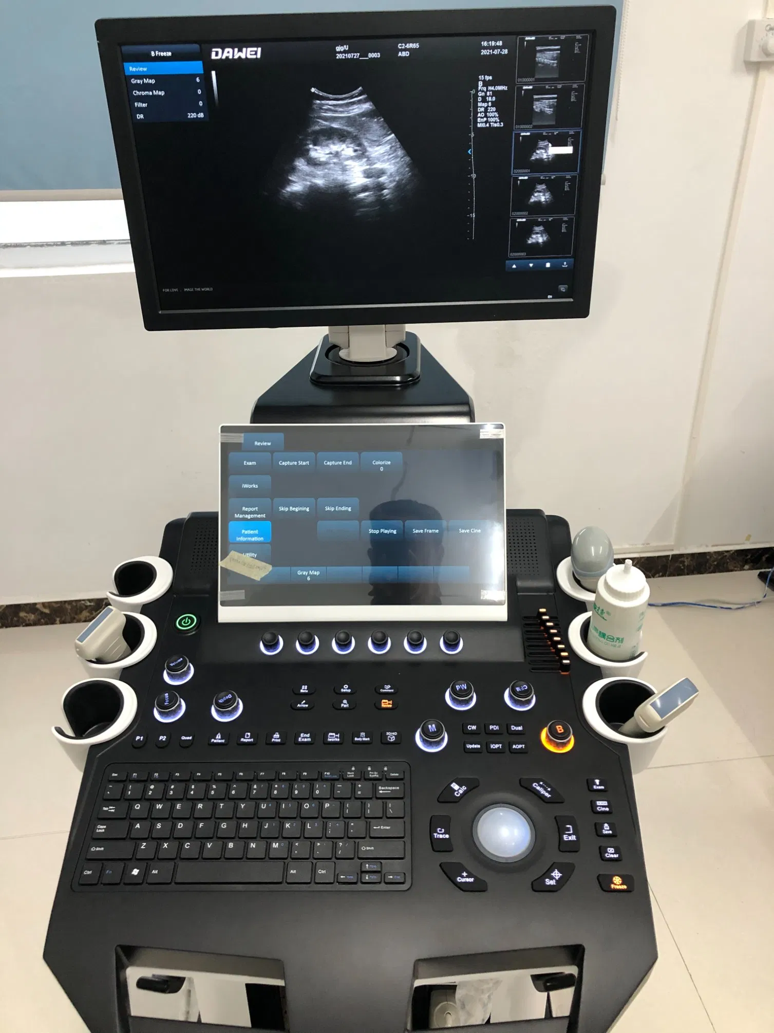 Dw-T50 Dual-Screen Cart-Based Color Doppler Ultrasound Diagnostic System with 4D Imaging