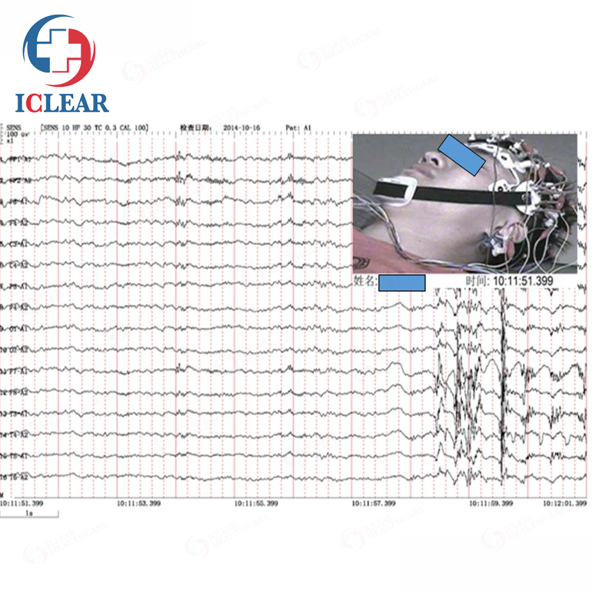 High Quality 32 Channel EEG System Digital Versatile Medical Electroencephalography