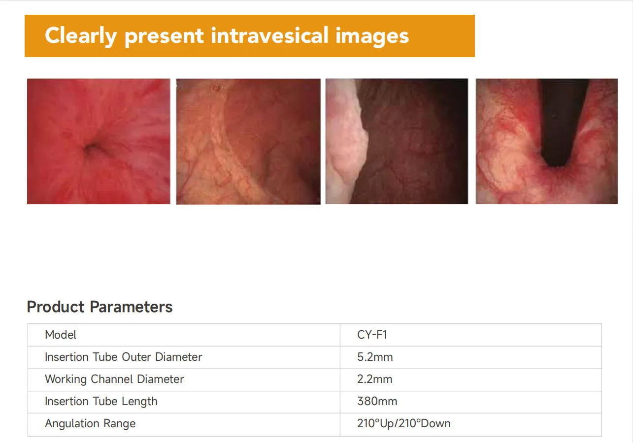 Flexible Ureteroscope View 7