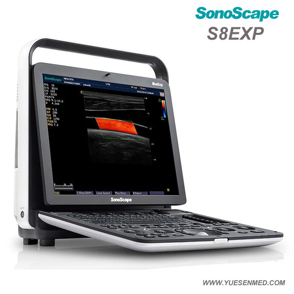 Medical Equipment Hospital Sonoscape S8exp Portable Cardiac Color Doppler Ultrasound Machine
