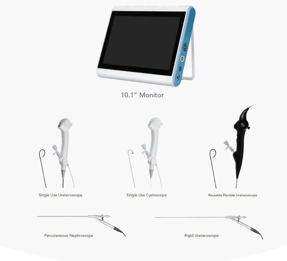Flexible Ureteroscope View 10