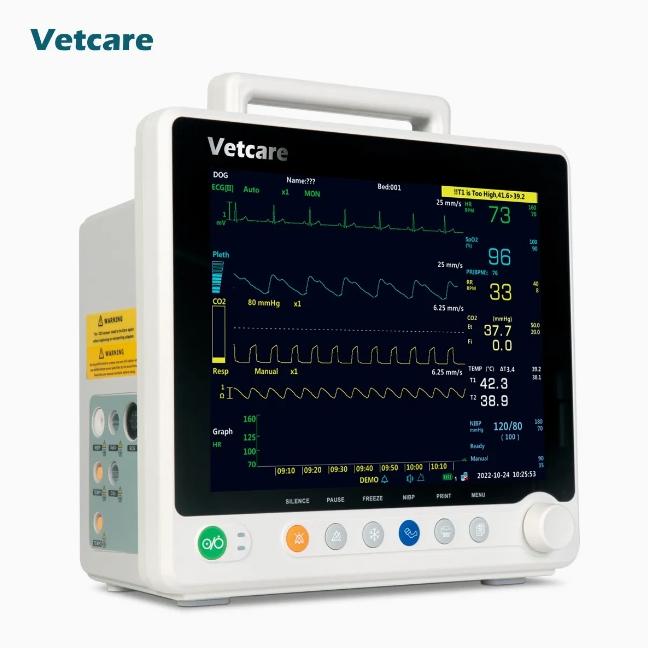 Advanced Cardiac Monitoring System for ECG Results Analysis Portable EKG Machine