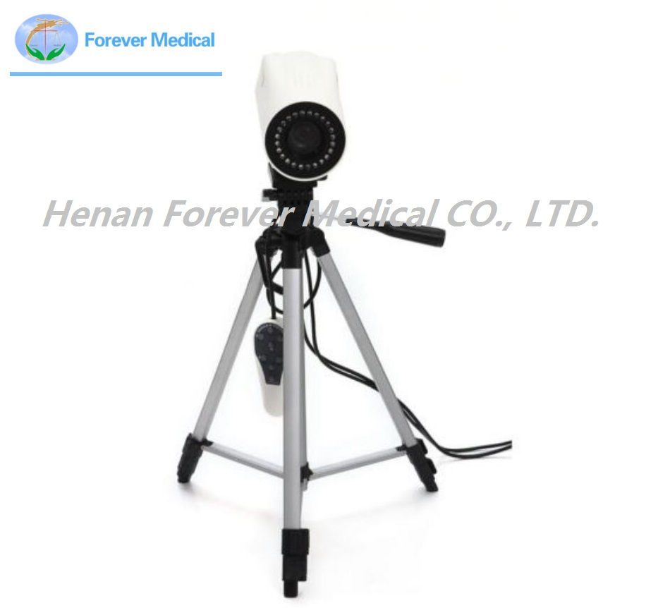 Ce Approved Portable Sony Colposcopy Systems for Gynecological (YJ-U150)