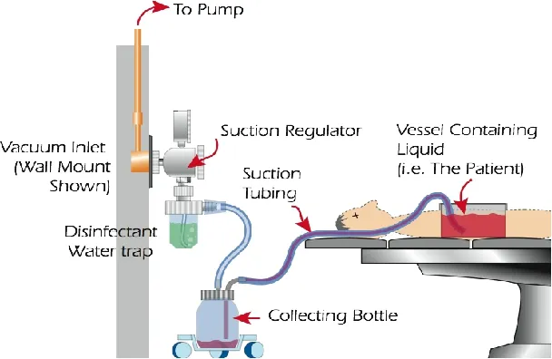 Medical Central Vacuum System Application