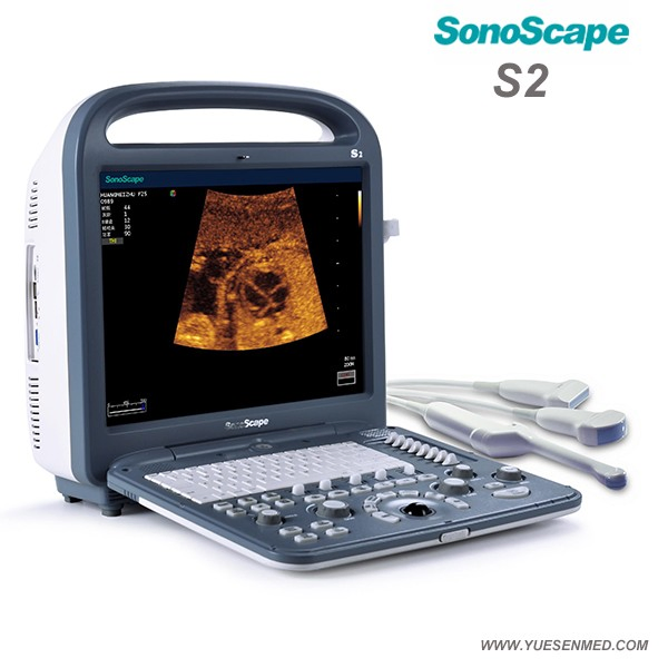 S2 Sonoscape 2D 3D 4D Multi Frequencies Color Doppler Ultrasound Scanner Machine