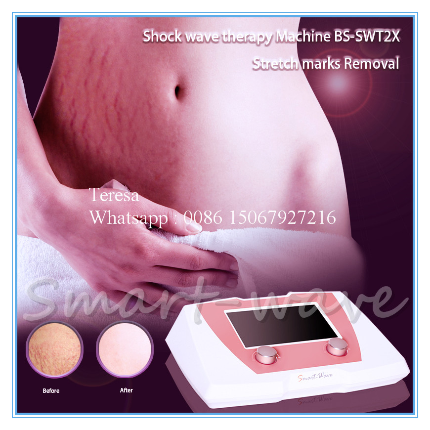 Radial Shockwave Therapy System: Advanced Solution for Female Health Enhancement