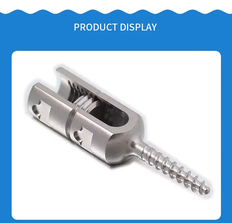 Posterior Spinal Fixation