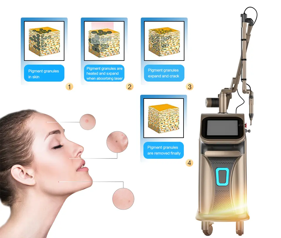 Pico Second Laser Application Overview