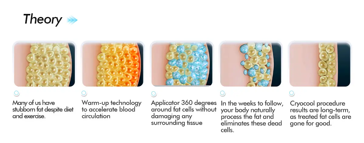 Cryolipolysis Fat Freeze Mechanism