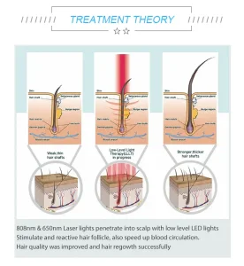 CE Certification Sano CE Approved hair Loss Treatment LLLT hair regrowth machine /Laser Hair Growth Suppliers, Supplier