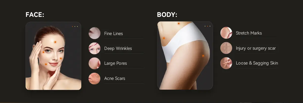 Body Treatment