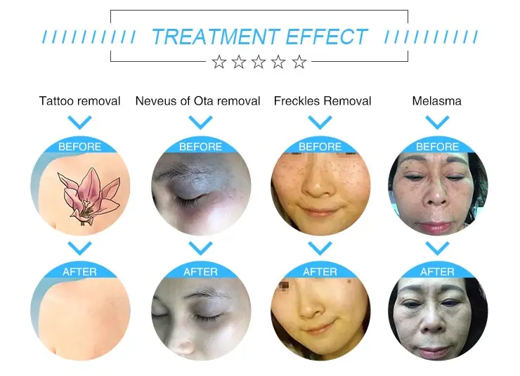 Treatment Range Image 2