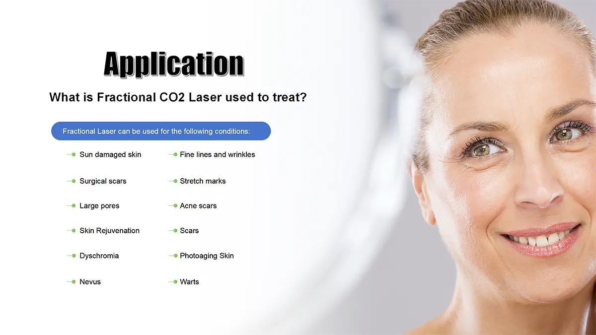 co2 laser skin resurfacing machine