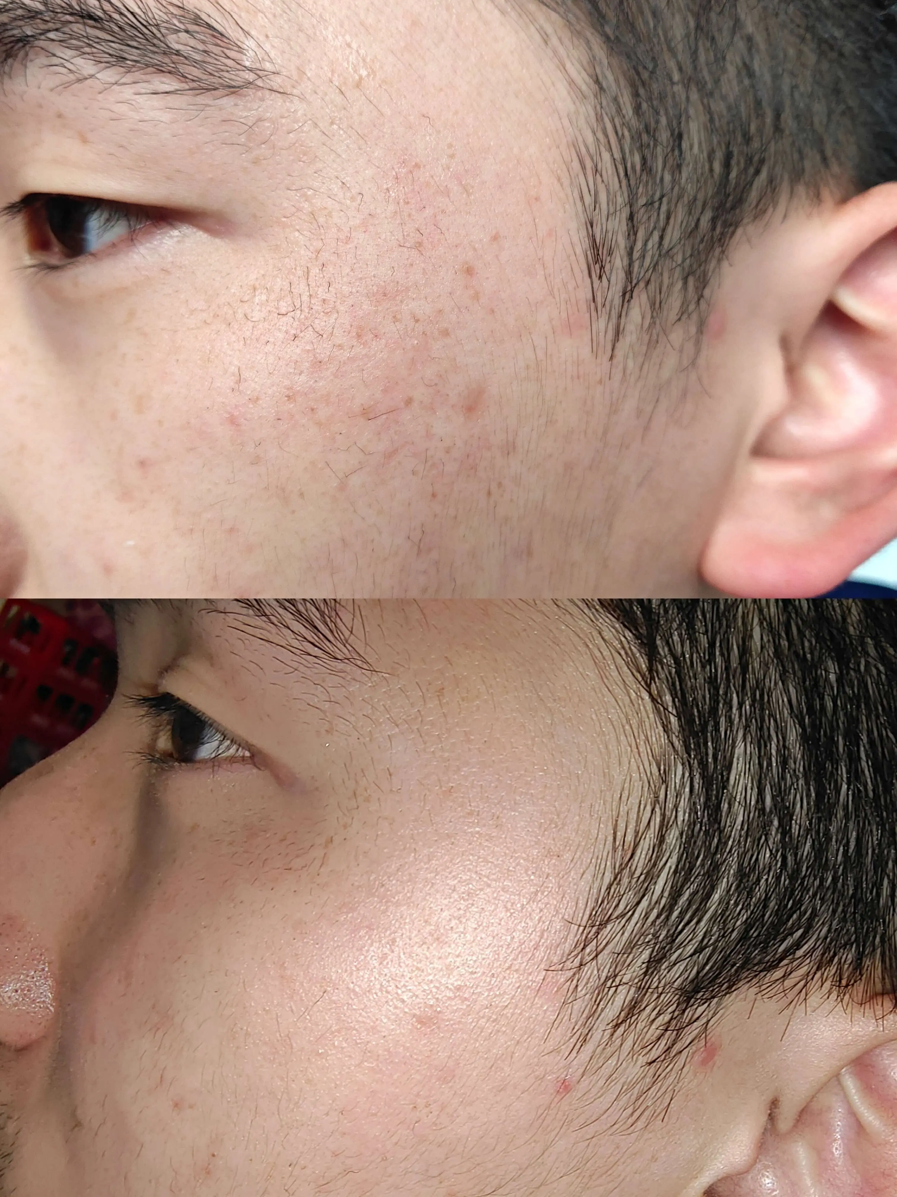 Before and After 1