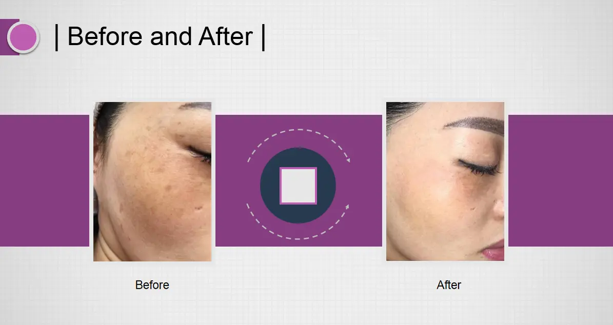 Treatment Results
