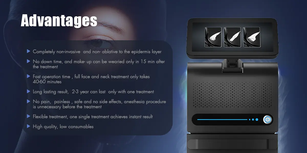 Advantages Overview