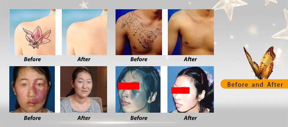Treatment Results