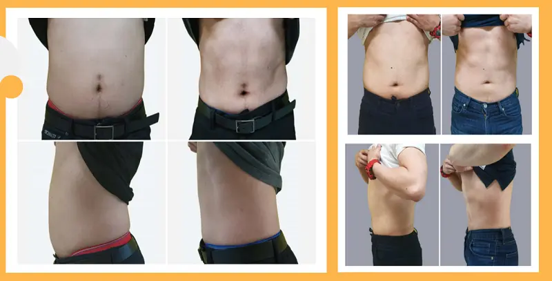 Treatment Effect Results