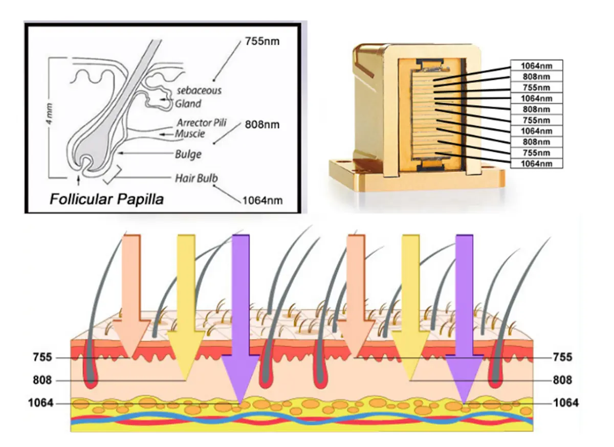 triple wavelength diode laser
