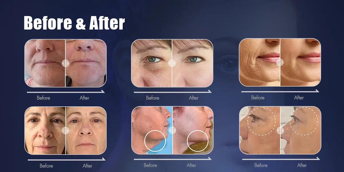 Before and After Results