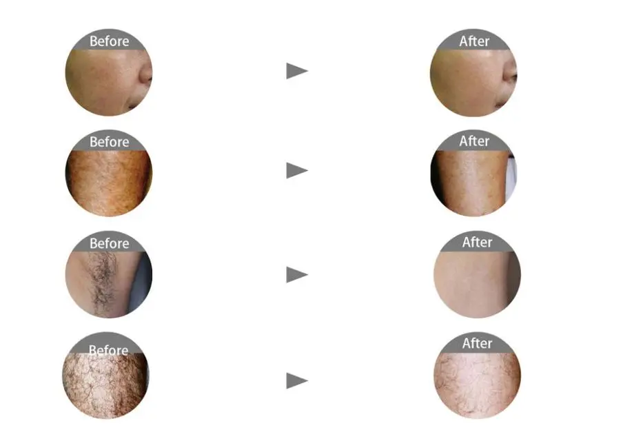 SHR Treatment Effect 1