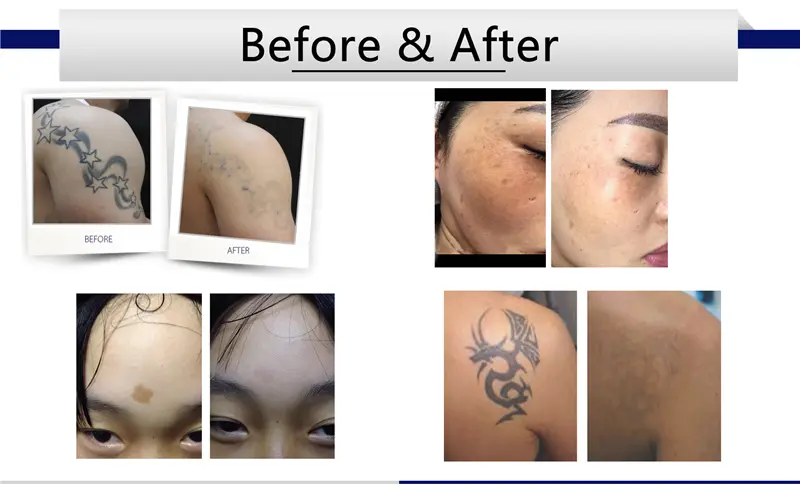 Treatment Results