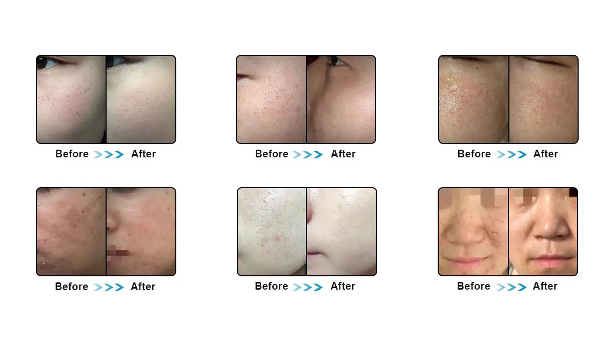 SHR Treatment Effect 2