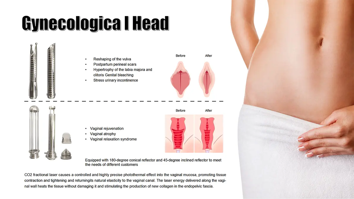 Gynecological Head Catalog