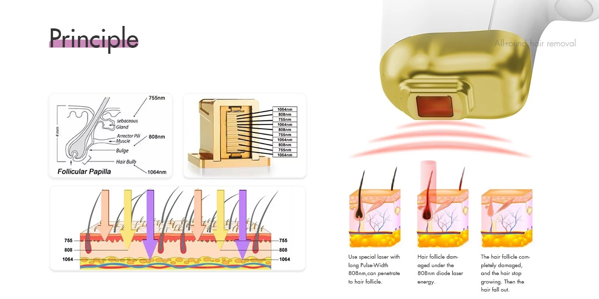 Diode Laser Principle Diagram