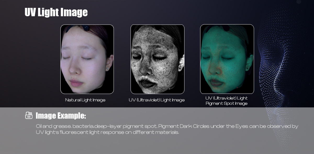 UV Light Image