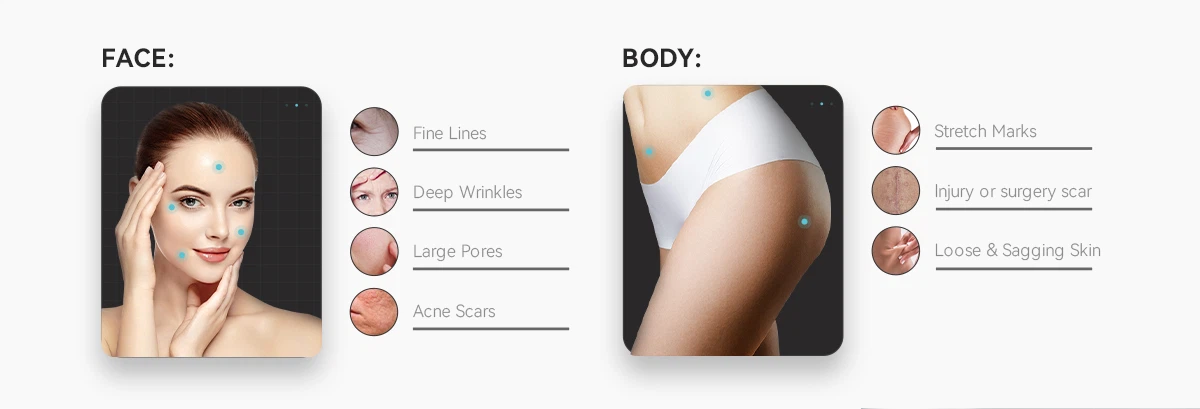 Body Treatment Applications