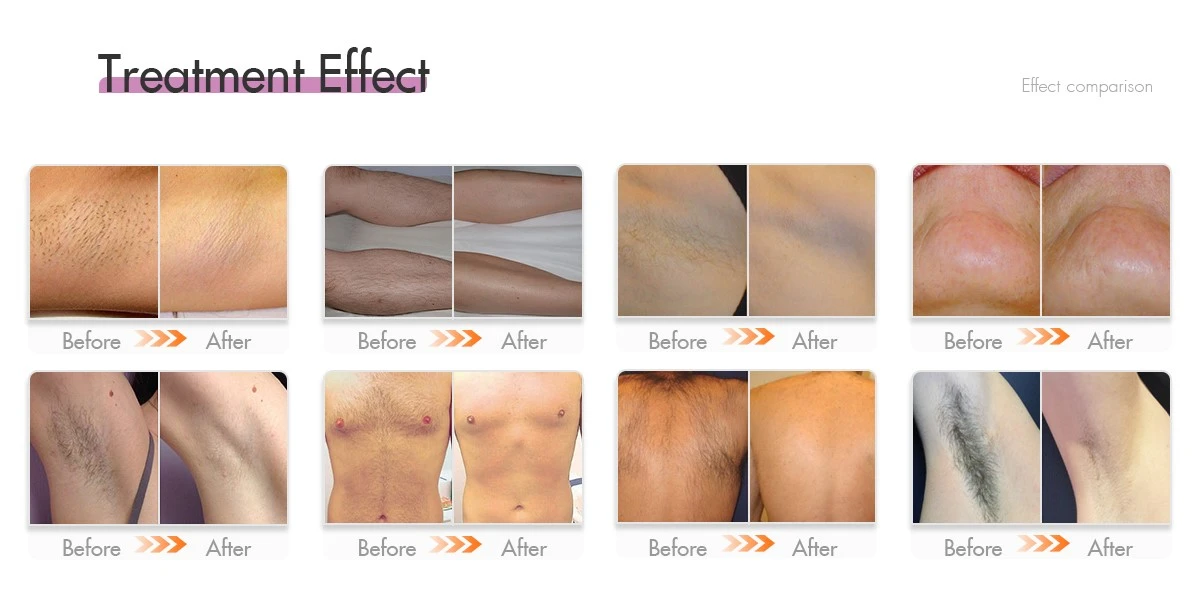 Before and After Treatment Effect