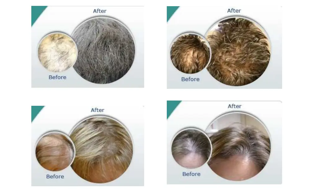 Treatment result 1