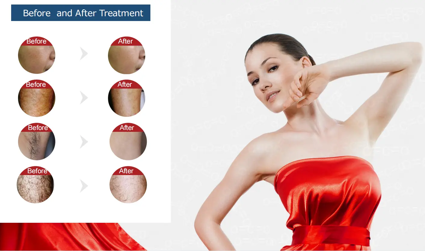 Before and after treatment 2