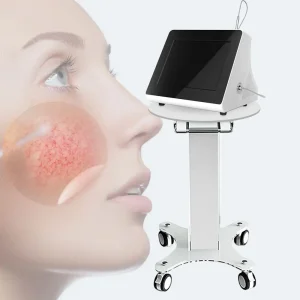 CE Certification 980 nm Diode Laser Spider Vein Removal